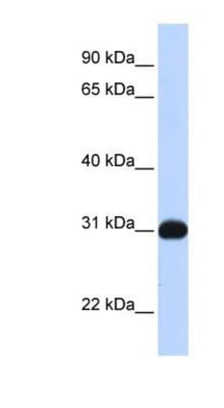 SHP/NR0B2/Nuclear Receptor SHP Antibody, Novus Biologicals 100μL; Unlabeled:Antibodies,