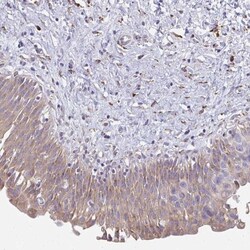 SHROOM1 Antibody, Novus Biologicals 0.1mL; Unlabeled:Antibodies, Polyclonal