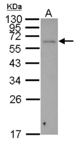 Shugoshin Antibody, Novus Biologicals 0.1mL; Unlabeled:Antibodies, Polyclonal