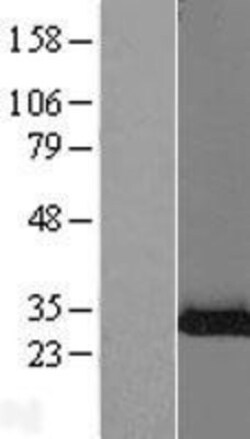 Novus Biologicals&trade;&nbsp;Ribosome maturation protein SBDS Overexpression Lysate