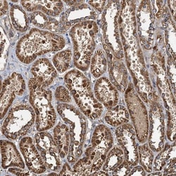 Serine Dehydratase Antibody, Novus Biologicals:Antibodies:Primary Antibodies