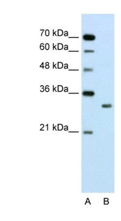 Ribosome maturation protein SBDS Antibody, Novus Biologicals:Antibodies:Primary