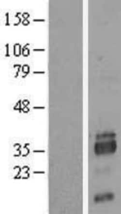 Novus Biologicals&trade;&nbsp;SIAH2 Overexpression Lysate