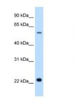 Sialin/SLC17A5 Antibody, Novus Biologicals 0.05mg; Unlabeled:Antibodies,