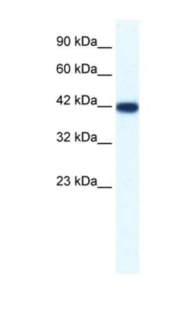 IBSP/Sialoprotein II Antibody, Novus Biologicals 0.1mg; Unlabeled:Anticorps,