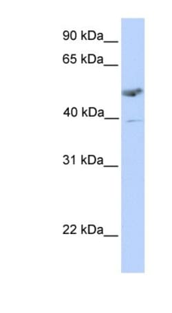ST3 beta-Gal alpha-2,3-Sialyltransferase 1/ST3GAL1/SIAT4A Antibody, Novus