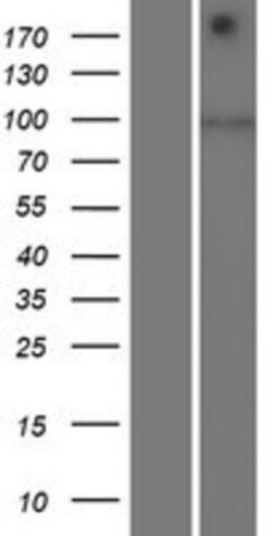 Novus Biologicals&trade;&nbsp;SIDT1 Overexpression Lysate