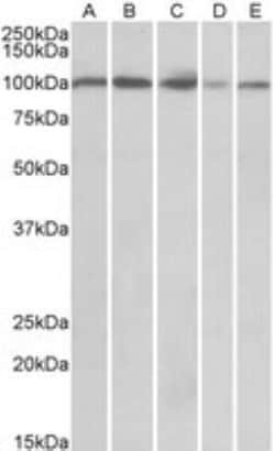 SIDT1 Antibody, Novus Biologicals 0.1 mg | Buy Online | Novus Biologicals | Fisher Scientific