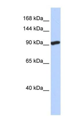 SIDT2 Antibody, Novus Biologicals 0.05mg; Unlabeled:Antibodies, Polyclonal