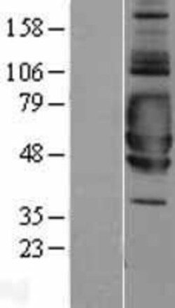 Novus Biologicals&trade;&nbsp;SIGIRR Overexpression Lysate