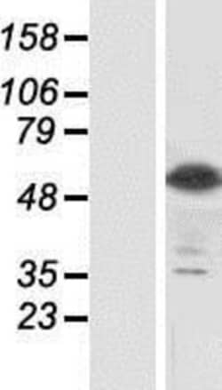 Novus Biologicals&trade;&nbsp;Siglec-8 Overexpression Lysate