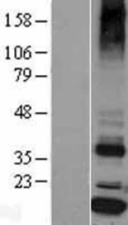 Novus Biologicals&trade;&nbsp;Signal sequence receptor delta Overexpression Lysate
