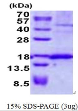 Novus Biologicals&trade;&nbsp;Recombinant Human Signal sequence receptor delta His Protein
