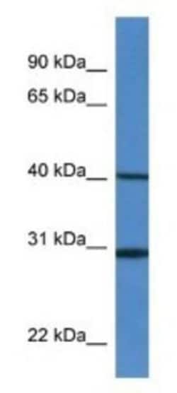 Signal Peptide Peptidase Antibody, Novus Biologicals:Antibodies:Primary