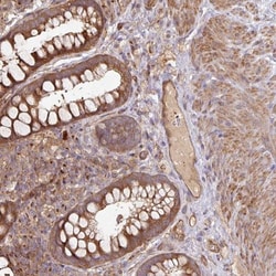 SIK1/Snf1lk Antibody, Novus Biologicals 0.1mL; Unlabeled:Antibodies, Polyclonal