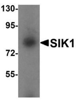 SIK1/Snf1lk Antibody - BSA Free, Novus Biologicals:Antibodies:Primary Antibodies