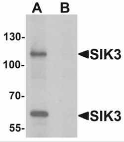 SIK3 Antibody - BSA Free, Novus Biologicals:Antibodies:Primary Antibodies