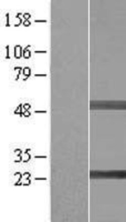 Novus Biologicals&trade;&nbsp;SIKE1 Overexpression Lysate
