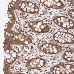 SIKE1 Antibody, Novus Biologicals:Antibodies:Primary Antibodies