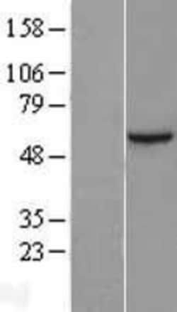 Novus Biologicals&trade;&nbsp;Sin1/MAPKAP1 Overexpression Lysate