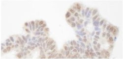 SIN3A Antibody, Novus Biologicals 0.1mL; Unlabeled:Antibodies, Polyclonal