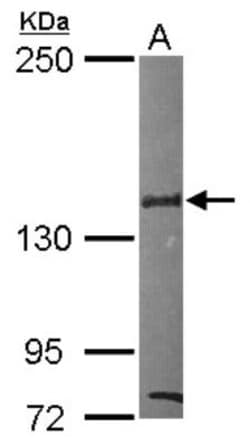 SIN3B Antibody, Novus Biologicals 0.1mL; Unlabeled:Antibodies, Polyclonal