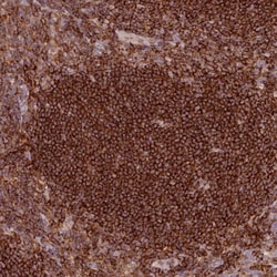 SIPA1 Antibody, Novus Biologicals 0.1mL; Unlabeled:Antibodies, Polyclonal