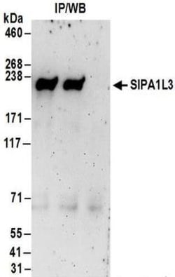 SIPA1L3 Antibody, Novus Biologicals 0.1mg; Unlabeled:Antibodies, Polyclonal