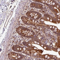 SIRPB2 Antibody, Novus Biologicals 0.1mL; Unlabeled:Antibodies, Polyclonal