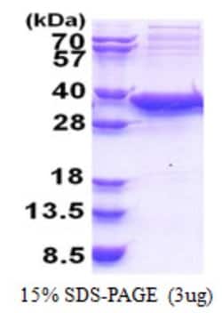 Novus Biologicals Recombinant Human Sirtuin 5/SIRT5 His Protein 0.1 mg | Buy Online | Novus Biologicals&trade; | Fisher Scientific