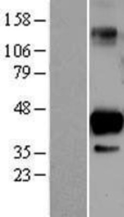 Novus Biologicals&trade;&nbsp;SIRT6 Overexpression Lysate