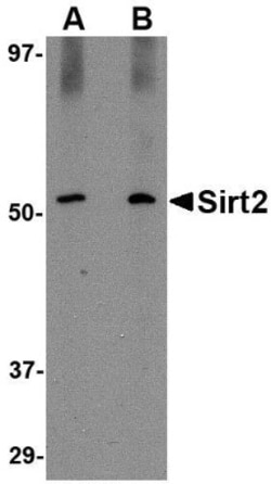 Sirtuin 2/SIRT2 Antibody - BSA Free, Novus Biologicals 0.025 mg | Buy Online | Novus Biologicals | Fisher Scientific