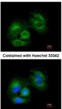 Sirtuin 3/SIRT3 Antibody, Novus Biologicals 0.1mg; Unlabeled:Antibodies,