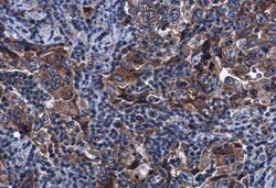 Sirtuin 3/SIRT3 Antibody, Novus Biologicals 0.1mg; Unlabeled:Antibodies,