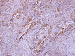 Sirtuin 3/SIRT3 Antibody, Novus Biologicals 0.1mg; Unlabeled:Antibodies,
