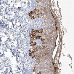 Sirtuin 3/SIRT3 Antibody, Novus Biologicals:Antibodies:Primary Antibodies