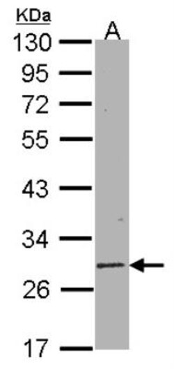 Sirtuin 3/SIRT3 Antibody, Novus Biologicals 0.1mg; Unlabeled:Antibodies,