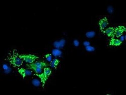 Sirtuin 5/SIRT5 Antibody (OTI2F1), Novus Biologicals 0.1mL; Unlabeled:Antibodies,