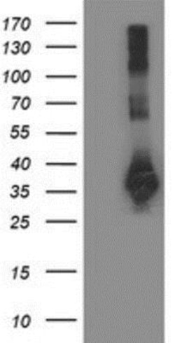 Sirtuin 5/SIRT5 Antibody (OTI2F1), Novus Biologicals 0.1mL; Unlabeled:Antibodies,