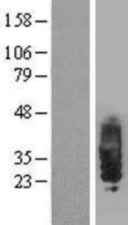 Novus Biologicals&trade;&nbsp;SIT1 Overexpression Lysate