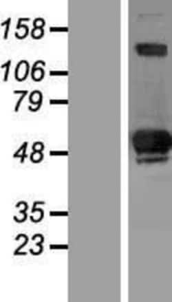 Novus Biologicals&trade;&nbsp;SIVA Overexpression Lysate