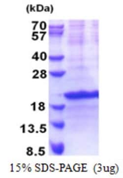 Novus Biologicals&trade;&nbsp;Recombinant Human SIVA His Protein