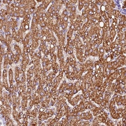 SIX5 Antibody, Novus Biologicals 0.1mL; Unlabeled:Antibodies, Polyclonal