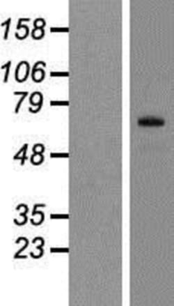 Novus Biologicals&trade;&nbsp;SIX5 Overexpression Lysate