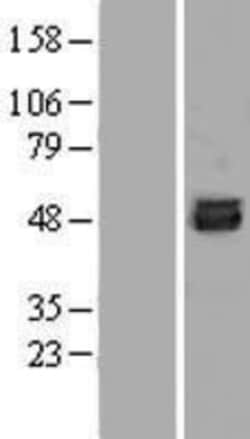 Novus Biologicals™ SKA3 Overexpression Lysate
