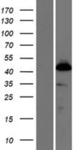 Novus Biologicals&trade;&nbsp;SKA3 Overexpression Lysate