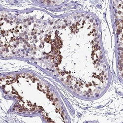 SKA3 Antibody, Novus Biologicals:Antibodies:Primary Antibodies