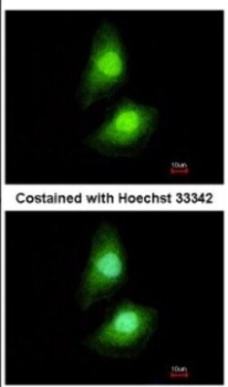 SKAP55 Antibody, Novus Biologicals 0.1mL; Unlabeled:Antibodies, Polyclonal