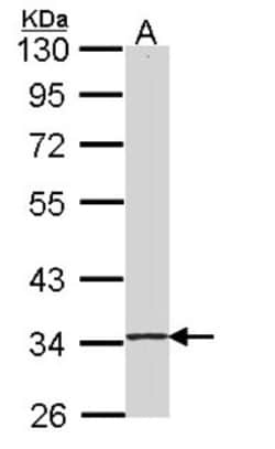 SKAP55 Antibody, Novus Biologicals 0.1mL; Unlabeled:Antibodies, Polyclonal