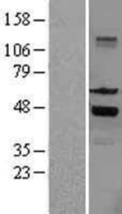Novus Biologicals SKAP55 Overexpression Lysate